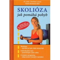 SKOLIÓZA SKOLIÓZA